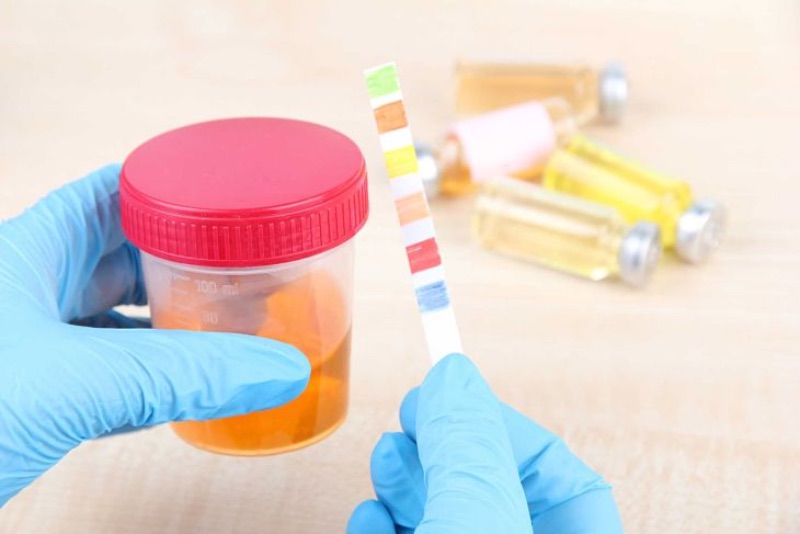 chi phí chữa rối loạn cương dương