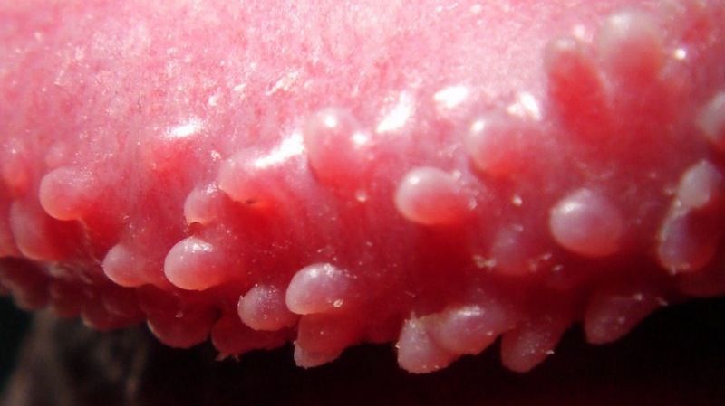 chuỗi hạt ngọc dương vật có tự hết không