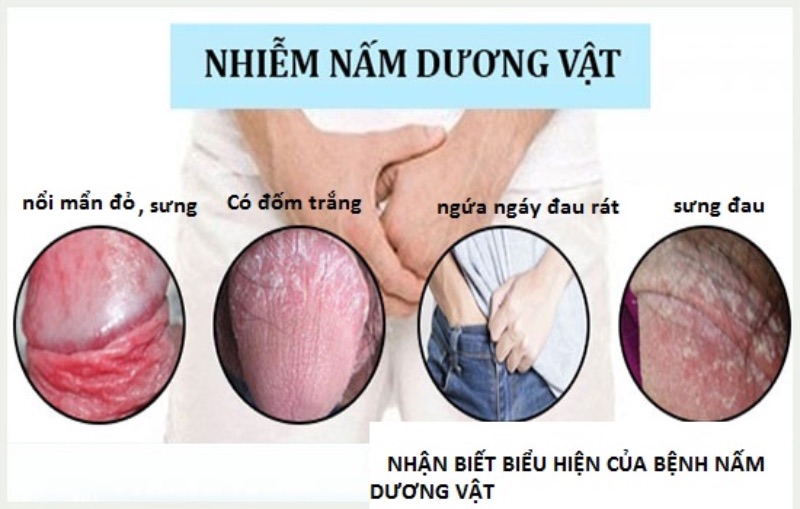 da dương vật bị khô
