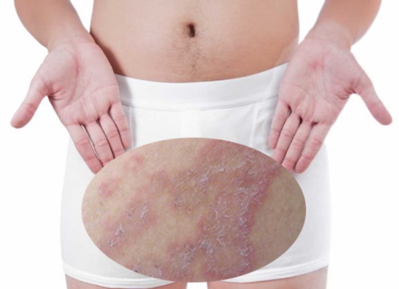 da dương vật bị khô