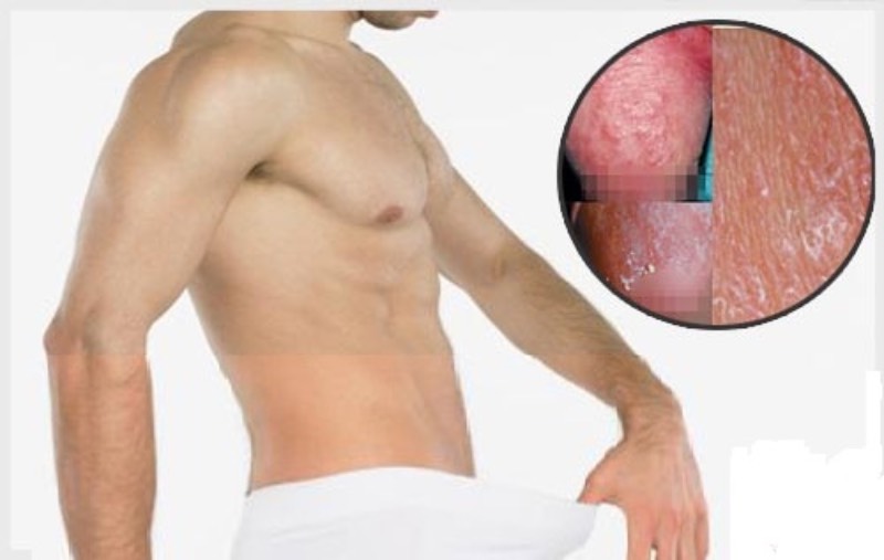đầu dương vật bị khô
