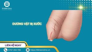 Dương vật bị xước