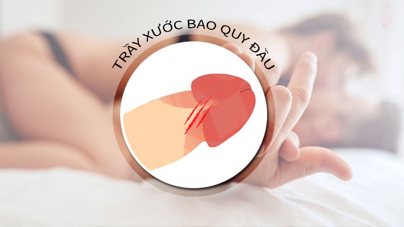 dương vật bị xước