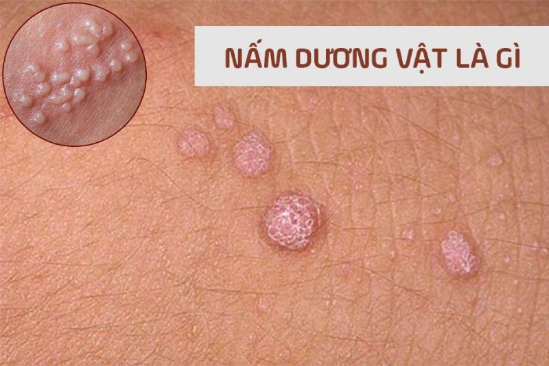 dương vật bị xước