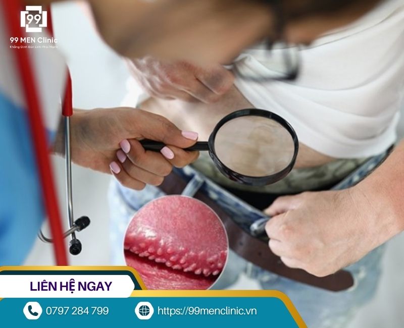 Kiểm tra hạt ngọc dương vật bằng mắt thường