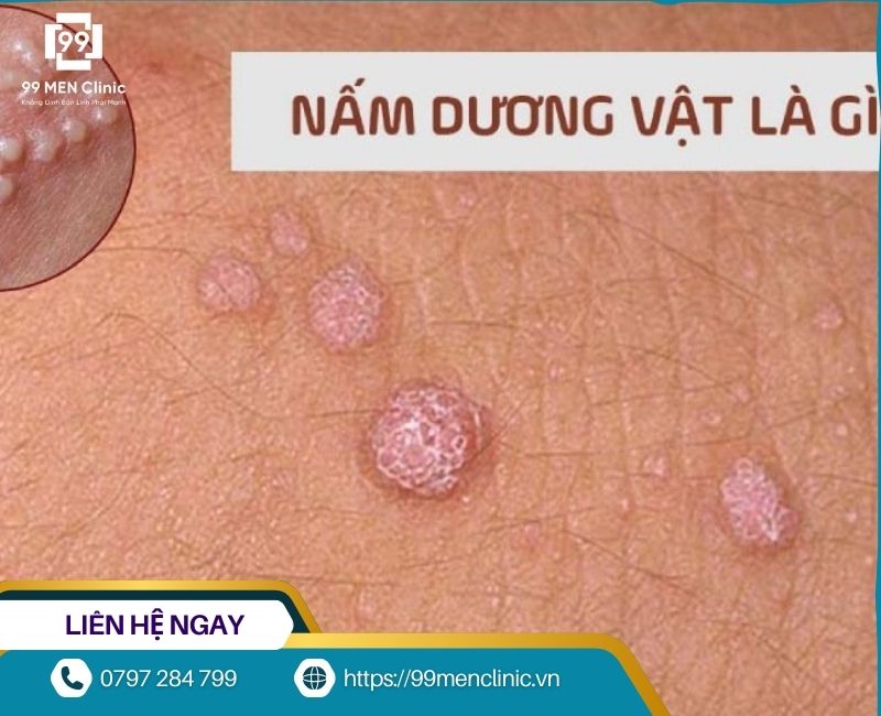 Nấm Candida khiến dương vật ngứa rát và xước