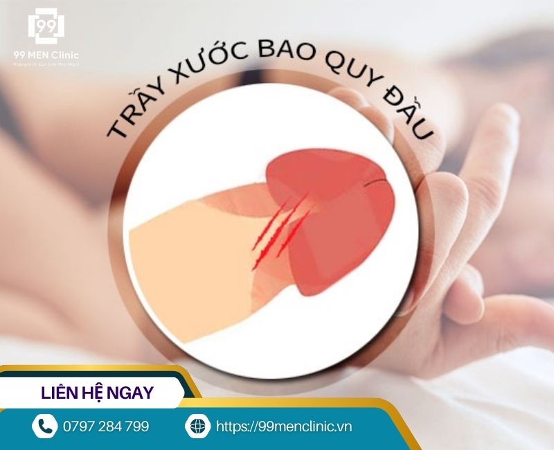 Quan hệ mạnh, sai cách có thể khiến xước cậu nhỏ