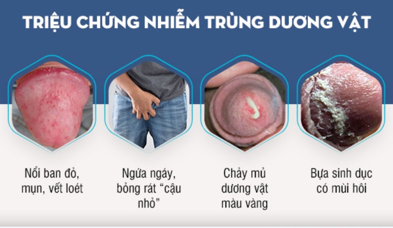 vô bi cho dương vật