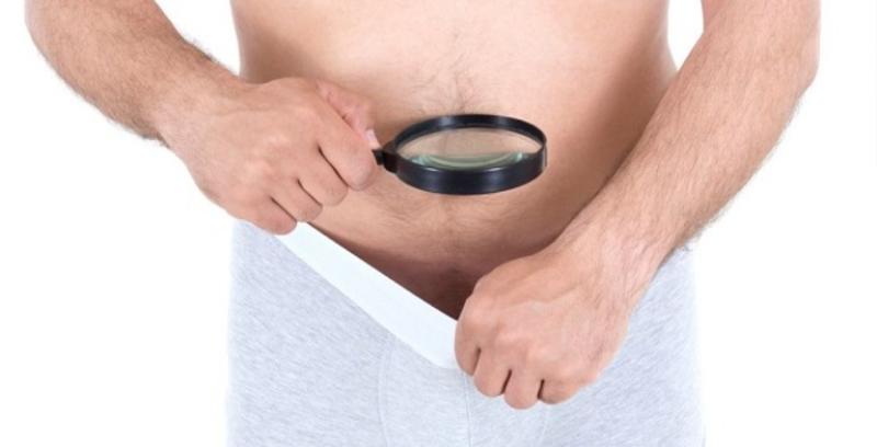 Nam giới cần cách chăm sóc vùng kín cẩn thận sau khi cắt bao quy đầu