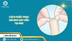 Cách khắc phục dài bao quy đầu tại nhà