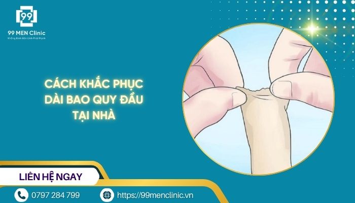Cách khắc phục dài bao quy đầu tại nhà