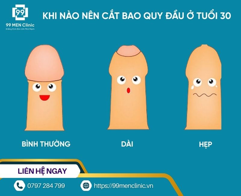 Cắt bao quy đầu ở tuổi 30