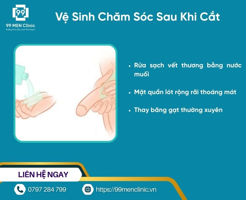 Chăm sóc tại nhà sau khi cắt