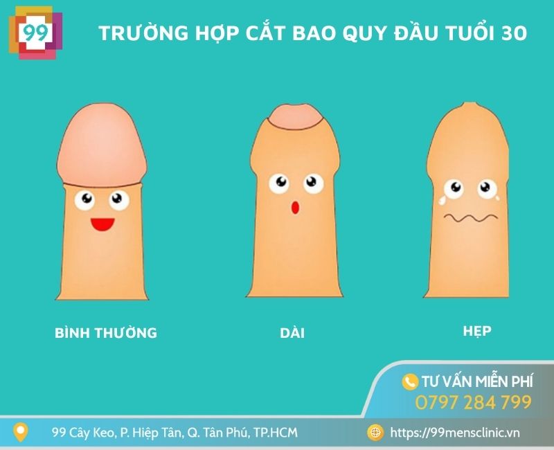 Trường hợp nam giới cần cắt bao quy đầu tuổi 30