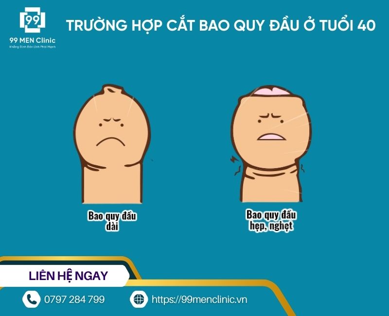 Trường hợp cắt bao quy đầu tuổi 40