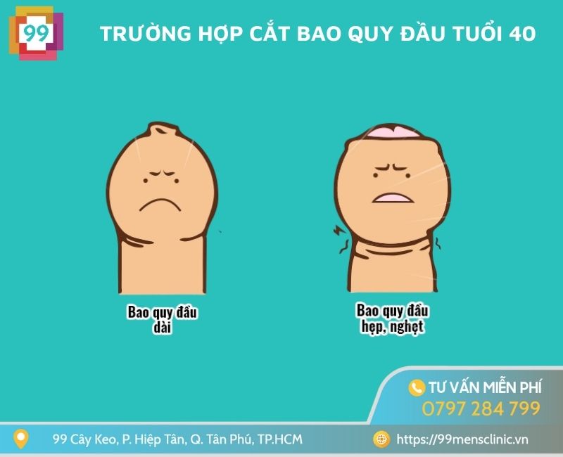 Trường hợp cắt bao quy đầu tuổi 40
