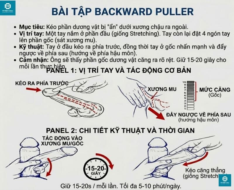 Bài tập Backward Puller