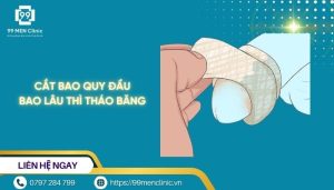 Cắt bao quy đầu bao lâu thì tháo băng