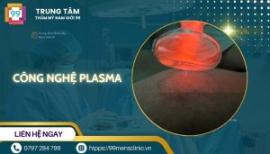 Công nghệ plasma