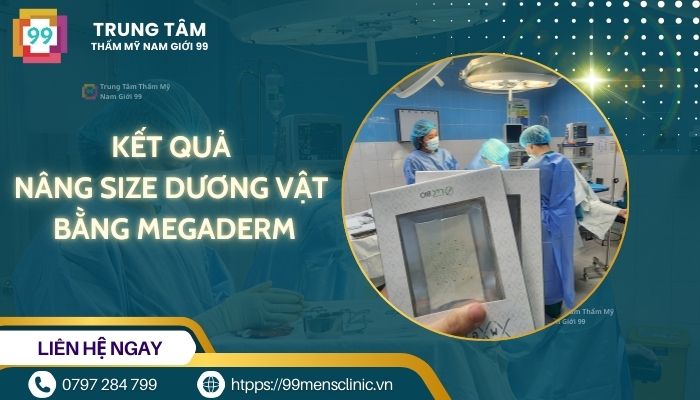 Nâng size dương vật bằng megaderm