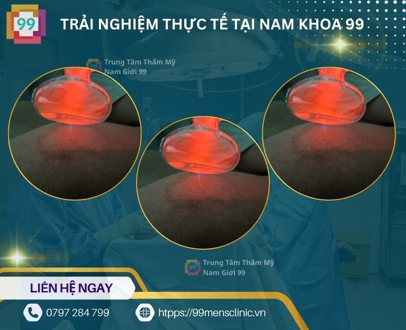 Khách hàng trải nghiệm thực tể tại 99