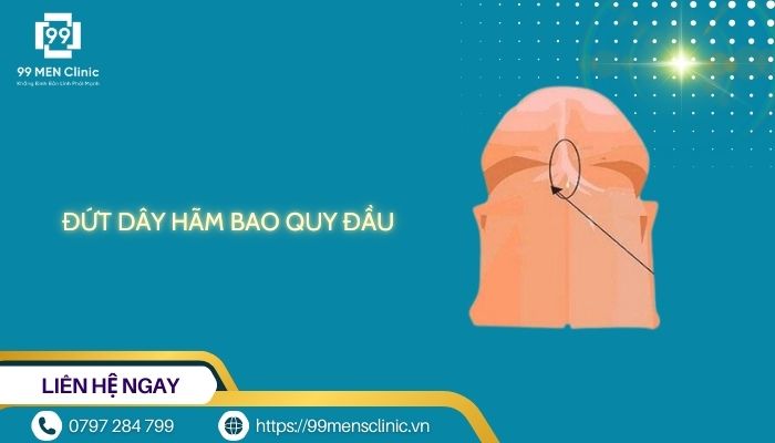 Đứt dây hãm bao quy đầu