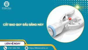 Cắt bao quy đầu bằng máy