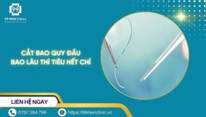Cắt bao quy đầu bao lâu thì tiêu hết chỉ