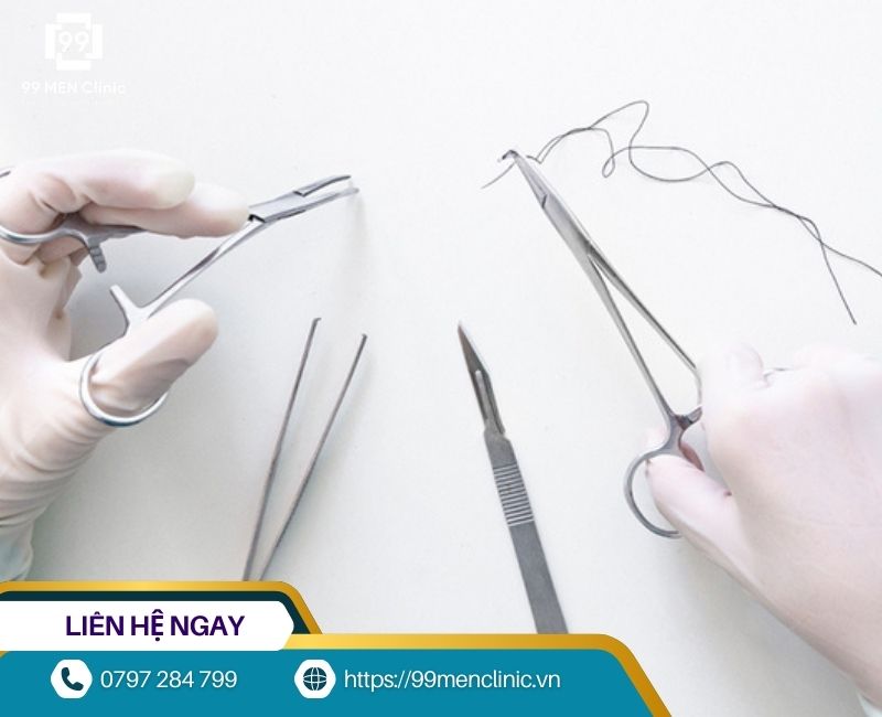 Chỉ dùng trong tiểu phẫu cắt bao quy đầu