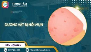 Dương vật bị nổi mụn