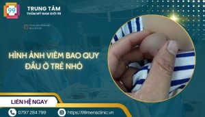Hình ảnh viêm bao quy đầu ở trẻ nhỏ