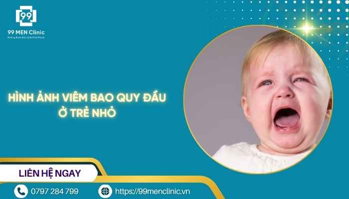 Hình ảnh viêm bao quy đầu ở trẻ nhỏ