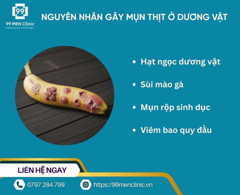 Nguyên nhân gây mụn thịt ở dương vật
