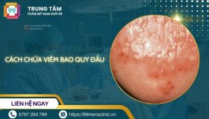 cách chữa viêm bao quy đầu