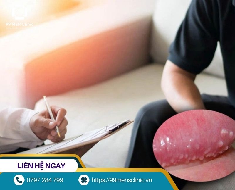 Chuỗi hạt ngọc dương vật có gây nguy hiểm không