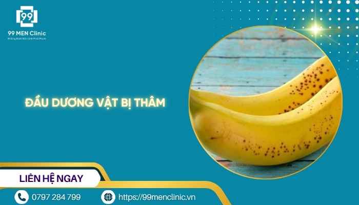 Đầu dương vật bị thâm