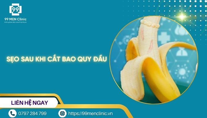 Sẹo sau khi cắt bao quy đầu