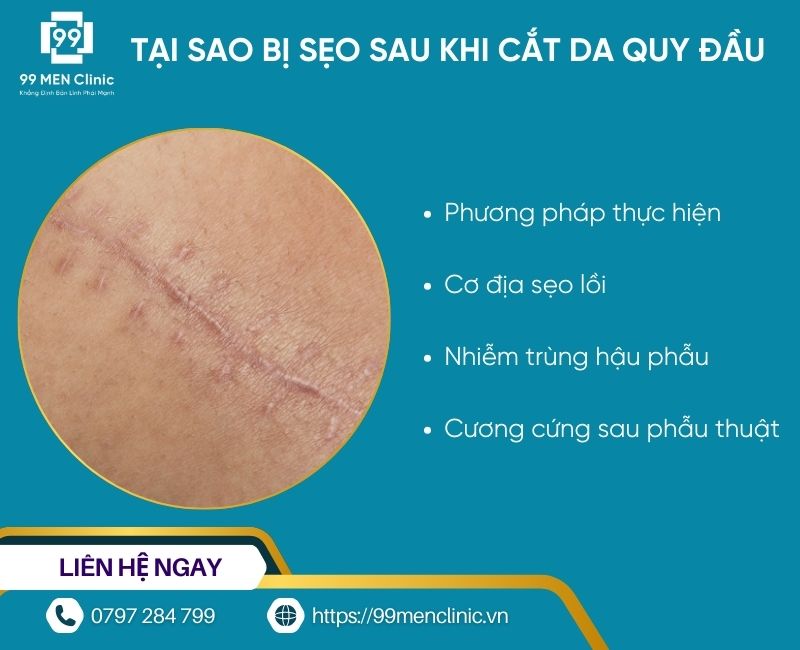 Tại sao bị sẹo sau khi cắt bao quy đầu