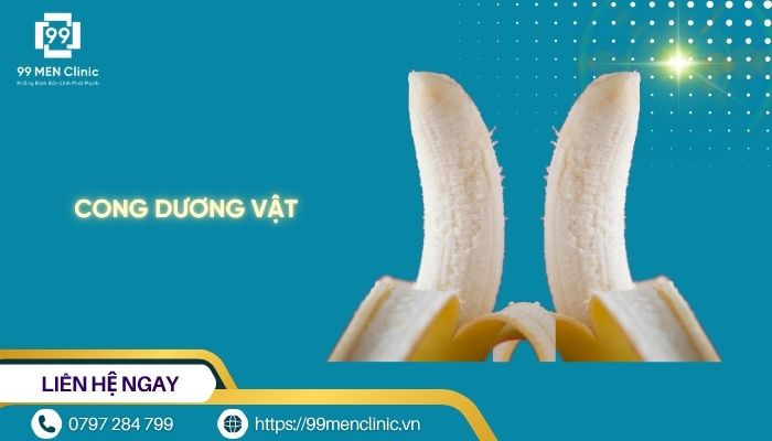 Cong dương vật