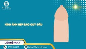 Hình ảnh hẹp bao quy đầu