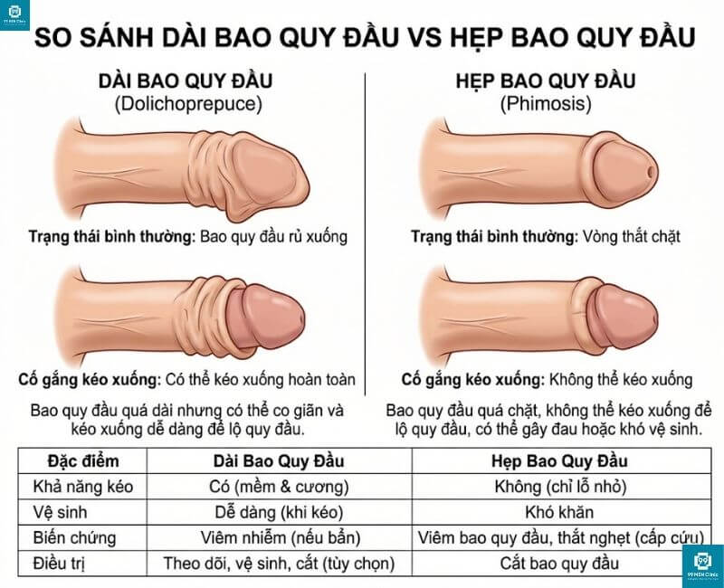Hình ảnh phân biệt dài bao quy đầu và hẹp bao quy đầu qua quan sát thực tế