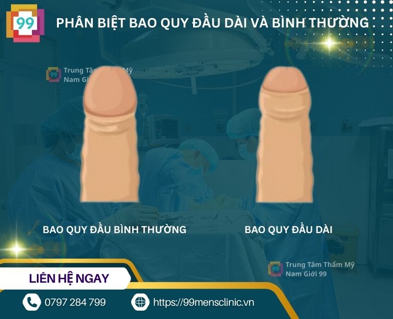 Phân biệt bao quy đầu dài