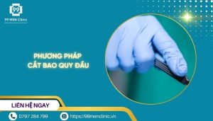 Phương pháp cắt bao quy đầu