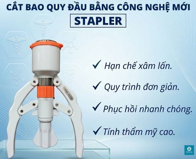 Phương pháp cắt bao quy đầu bằng Stapler