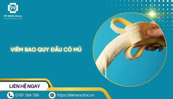 Viêm bao quy đầu có mủ