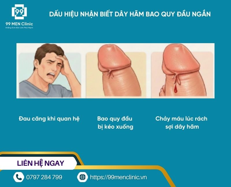 Dấu hiệu ngắn dây hãm bao quy đầu