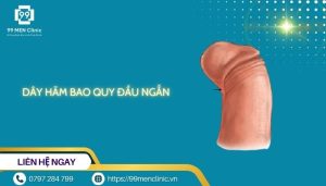 Dây hãm bao quy đầu ngắn