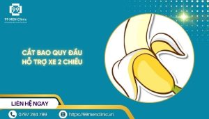 Cắt bao quy đầu hỗ trợ xe 2 chiều