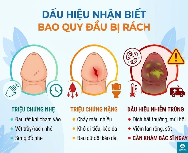 Dấu hiệu nhận biết bao quy đầu bị rách