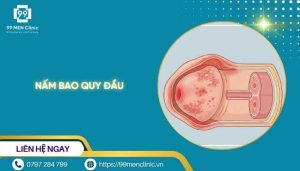 Nấm bao quy đầu